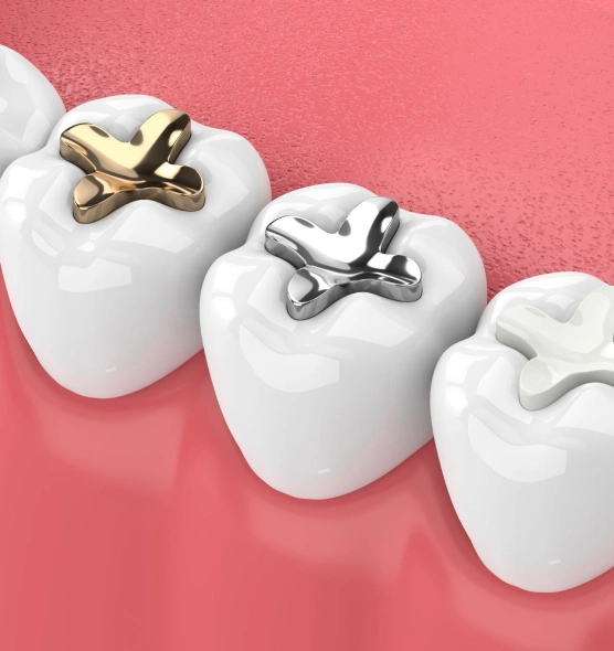 Three white tooth models on pink background displaying gold and silver dental crown options.