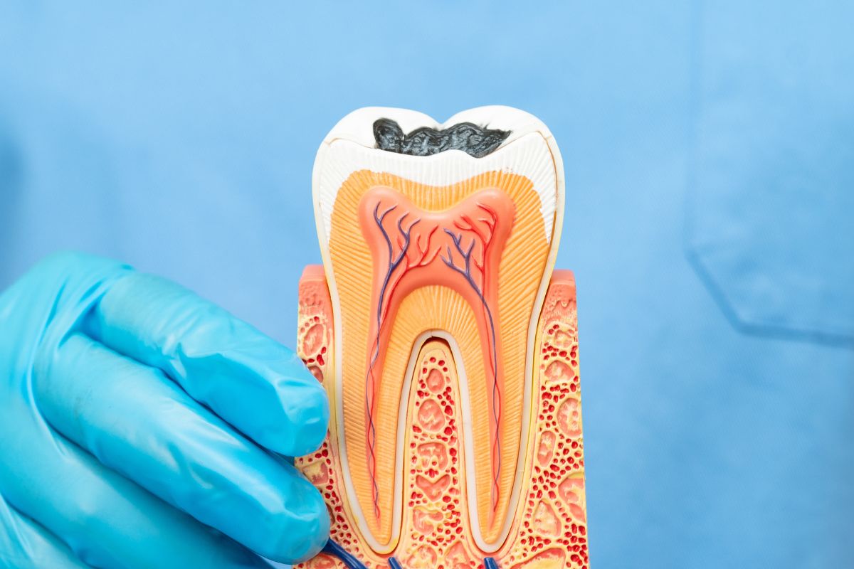 Think That Small Cavity Can Wait Here’s Why Falcon Dentists Say Otherwise